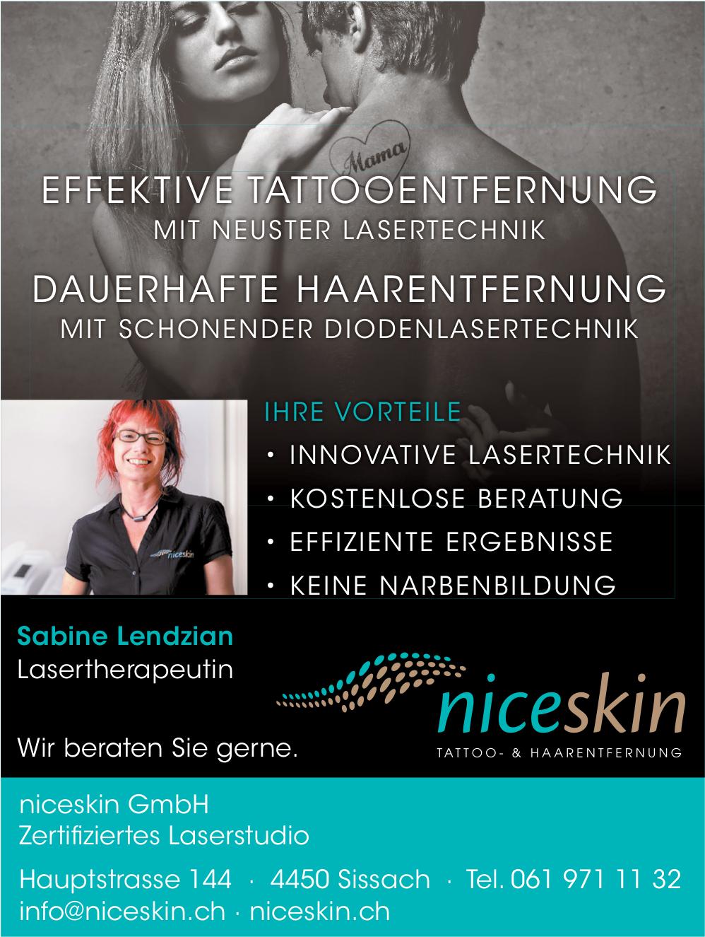 niceskin GmbH, Sissach - EFFEKTVE TATTOOENTFERNUNG